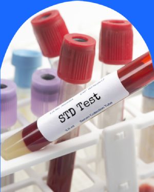 STD Testing Near Me in Cromwell CT, East Haven CT, Ellington CT, Newington, CT, Oxford, CT, Unionville CT, Wallingford, CT, Chicopee MA, Springfield MA and Westfield MA STD Testing Near Me in Cromwell CT, East Haven CT, Ellington CT, Newington, CT, Oxford, CT, Unionville CT, Wallingford, CT, Chicopee MA, Springfield MA and Westfield MA
